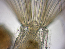 Moostierchen, Bryozoa.