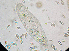 Pantoffeltierchen, Paramecium