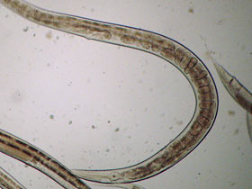 Mikrowürmchen - Panagrellus redivivus: Geburtsöffnung.