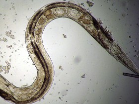 Mikrowürmchen - Panagrellus redivivus: Uterus.